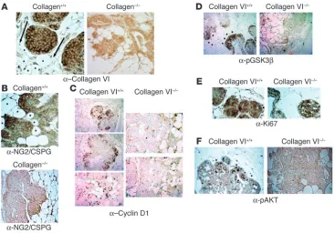 Figure 4Immunohistochemical analysis of pathologically matched tumors from collagen