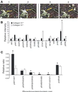 Figure 5Breast tumor cell protein expression and activation differences between col-