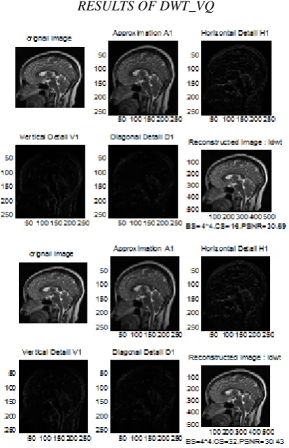 Fig. 3.7   Different DWT_VQ single stage reconstructed images 
