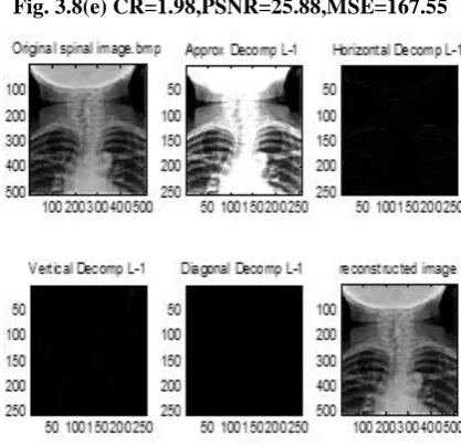 Fig. 3.8(c) CR=3.91,PSNR=24.23,MSE=245.40     