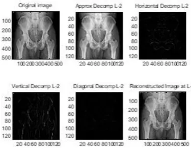 Fig. 3.8(l) CR=5.47,PSNR=27.69,MSE=110.52  