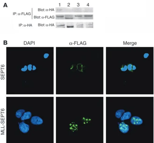 Figure 3Oligomerization of MLL-SEPT6 fusion protein through both its 