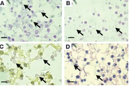 Figure 4VAD1neoformansbrain. (a sense tive yeast cells. (line phosphatase–negative yeast cells