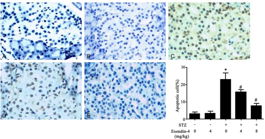 Figure 6. Effect of Exendin-4 on islet cell apoptosis in T1DM rats. *, P<0.05 compared to control group; #, P<0.05 compared to model group.