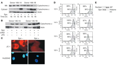 Figure 2Mitochondrial features of apoptosis are observed in macrophages infected with pneumococci