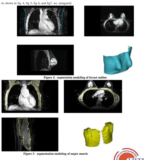 Figure 5.  segmentation modeling of major muscle 