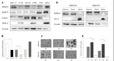 Fig. 2 Decreased expression of RNF43 protein in GC stem-like cells. a Western blot assay of RNF43, RNF75, Cul4a, and Sox-2 protein in cancer cellsand HGC-27 and N87 GC stem-like cells