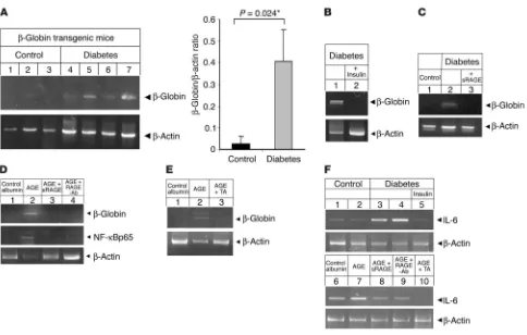 Figure 2Diabetes or AGE-albumin induces transcriptional activity of NF-