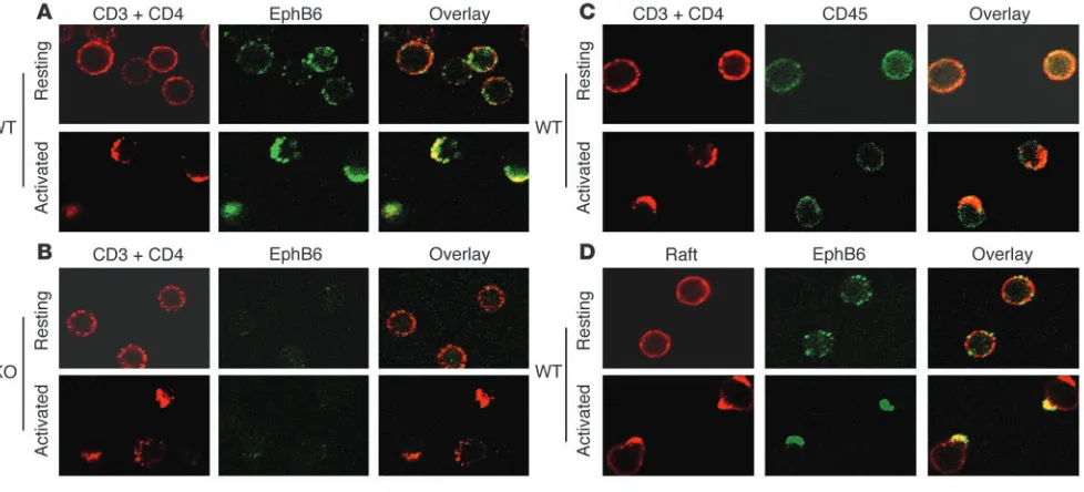Figure 6EphB6 cocapped with TCR and rafts upon TCR stimulation. Capping of thymocyte TCR (