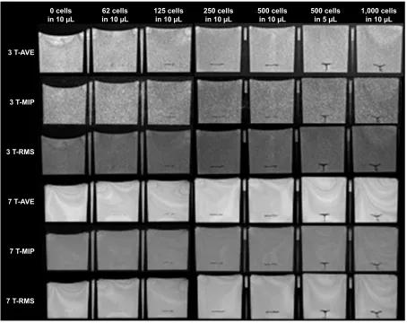 Figure S1 aVe, MIP, and rMs combined phase-cycled bssFP images of different concentrations of cells (0, 62, 125, 250, 500, and 1,000 cells in 10 µl medium including 500 cells in 5 µl medium) in the gelatin phantom.Note: Phase-cycled bssFP images were combined with three methods to minimize banding artifacts.Abbreviations: aVe, average of the signal; bssFP, balanced steady-state free precession; MIP, maximum intensity projection; rMs, root mean square.