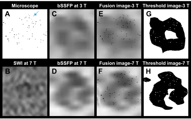 Figure 6 (A) 3D view of manually segmented volumes of labeled cells with different concentrations on sWI and rMs combined phase-cycled bssFP at 3 and 7 T