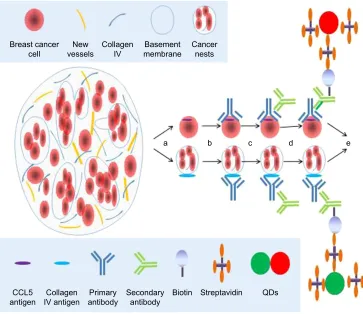 Figure 1 ccl5 and collagen IV testing.Notes: ccl5 expressed in the cytoplasm of cancer cell and collagen IV expressed in the BM were imaged and detected simultaneously and quantitatively by QD-based system