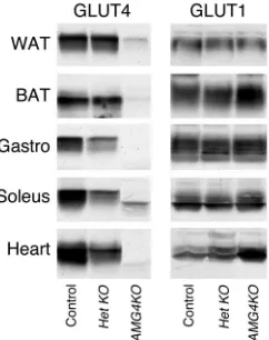 Figure 1Immunoblot analysis of GLUT4 and GLUT1 from control, (Gastro), soleus, and heart were prepared and immunoblotted with antibodies for GLUT4 or GLUT1