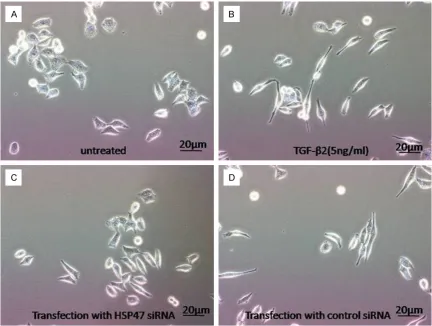 Figure 1. A: Cultured ARPE-19 cells presented similar round or polygonal; B: ARPE-19 cells changed into long shuttle shaped appearance stimulated by TGF-β2 (5 ng/ml); C: Transfection with HSP47 siRNA inhibited the change in cell morphology significantly; D: Transfection with control siRNA did not exert a significant influence in cell morphology.
