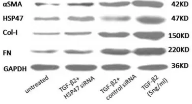 Figure 3. Treatment with recombinant TGF-β2 (5 ng/ml) induced 2.56±0.17 -fold, 3.01±0.31 fold, 2.42±0.21 fold, and 2.74±0.16 fold increase in HSP47, αSMA, FN, Col-I mRNA expression in 24h respectively; transfection with HSP47 siRNA resulted in a significant reduction in the TGF-β2-induced mRNA expression of the four proteins in ARPE-19 cells to 1.32±0.09 fold, 1.25±0.12 fold, 1.15±0.21 fold, and 1.22±0.11 fold as analyzed by RT-PCR.
