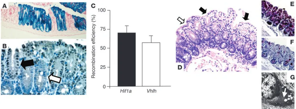 Figure 2Fabp-Cre–mediated recombination in the colon: analysis of Fabp-Cre activity and histological characterization of mutant mice
