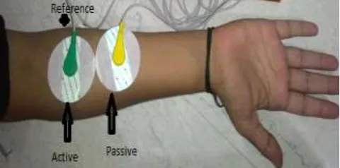 Figure 2.1 Block Diagram of Myoelectric Hand  