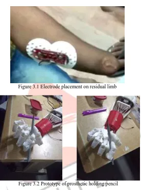 Figure 3.1 Electrode placement on residual limb  
