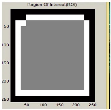 Fig.4. ROI Extraction  
