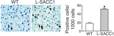 Figure 7Increased constitutive proliferation of L-SACC1 hepatocytes. Livers 