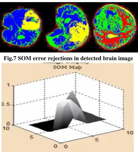 Fig.7 SOM error rejections in detected brain image 