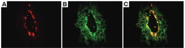 Figure 1RRV infection induces biliary inflammation and growth failure in neo-