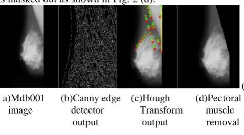 Fig. 2 Preprocessing of mammogram image                                                    