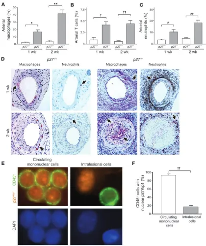 Figure 2p27red). Nuclear DAPI expression (blue) is also shown (lower panels). Original magnification, endogenous nuclear p27–/– mice develop arterial inflammation after vascular injury