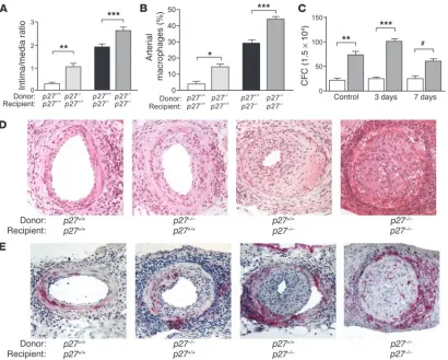 Figure 4p27Kip1 determines vascular proliferation and BM progenitor pool size. (A) p27–/– BM accelerates arterial lesion formation when transplanted into 