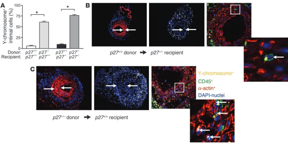 Figure 6Knockout of RAG confers protection against vascular proliferation. (A) RAG–/– arteries are protected against abnormal lesion formation 1 week 