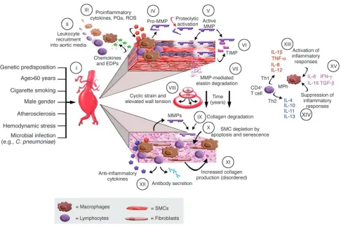 Figure 1Pathophysiology of abdominal aortic aneurysms. Schematic diagram illustrating events thought to contribute to the development and progression 