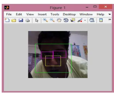 Fig. 4 Feature extraction 