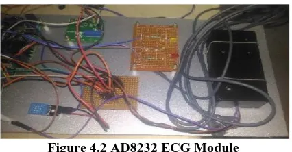 Figure 4.2 AD8232 ECG Module 