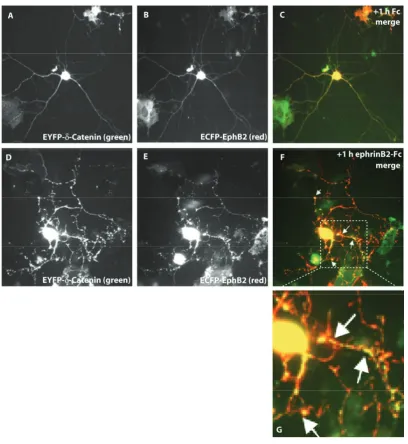 Figure 6.7: Fluorescently tagged ��control (panelsstrikingly changes its cellular distribution, forming aggregates that tend to become bigger overtime (other time points not shown)
