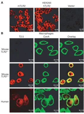 Figure 2Subcellular localization of TLR2 in vitro. Monoclonal antibody T2.5 was used for 