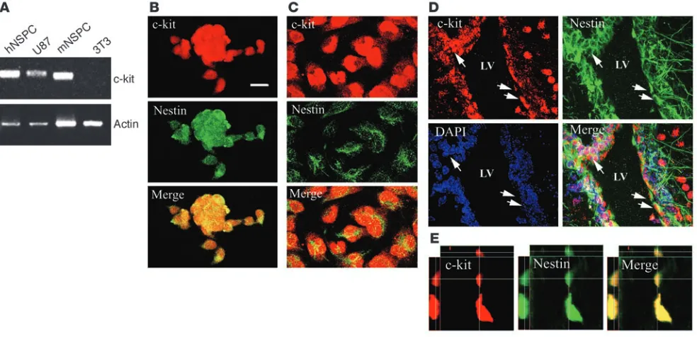 Figure 4Expression of c-kit in NSPCs in vitro and in vivo. (