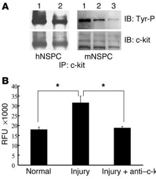 Figure 5SCF/c-kit pathway is involved in injury-induced NSPC migration. (