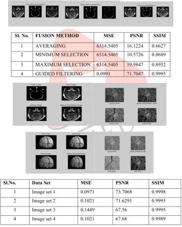Table 4.1 shows the analysis of different fusion techniques such as Averaging, Selection using Minimum, Selection using 