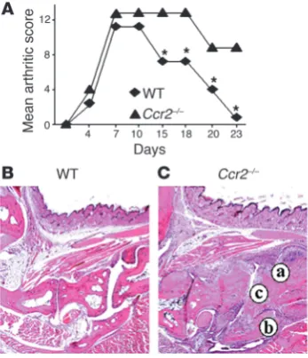 Figure 6Enhanced CAIA phenotype in induction of CAIA was determined in WT and with WT mice