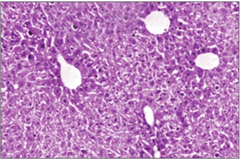 Figure 4. Group IV of Boerhaavia diffusa at 250 mg/kg and carbon tetrachloride (CCl4) showing almost complete protection of hepatocytes against CCl4 induced hepatoxicity.