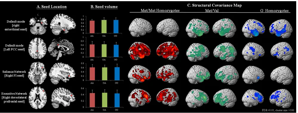 Figure 1: statistical maps depicting brain areas in which the gray matter intensity covaried with four target seeds A