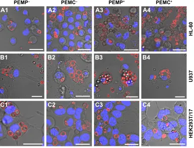 Figure 3 representative clsM images after co-incubating lbl-microparticles (columns 1 and 3) and lbl-microcapsules (columns 2 and 4) with negative (columns 1 and 2) or positive (columns 3 and 4) surface charge and different cell types (A: hl-60 cells, B: U937 cells and C: heK293T cells) to differentiate internalized lbl-microcarriers and lbl-microcarriers just adhering to the cell surface.Note: scale bars: 20 µm.Abbreviations: clsM, confocal laser scanning microscopy; lbl, layer-by-layer; PeMcs, polyelectrolyte-coated microcapsules; PeMPs, polyelectrolyte-coated microparticles.