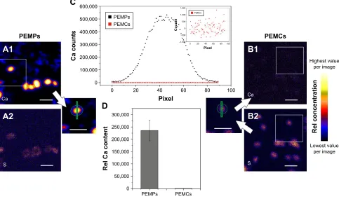 Figure 4 PIXe analysis of PeMPs and PeMcs to detect free ca after cacOPeMPs (black) and PeMcs (red) indicate the complete cacOAbbreviations:3 core dissolution.Notes: The ca-maps are shown in A1 (PeMPs) and B1 (PeMcs), whereas the s-maps are shown in A2 (Pe