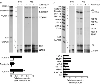 Figure 9Effect of Anti-VEGF on the intragraft expression of adhesion molecules and chemokines