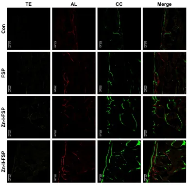 Figure 11 The area percent of fluorochrome stained bone in each group.Notes: The Te, al, and cc indicated the rate of new bone formation at the 2, 4, and 6 weeks after the operation, respectively; *P,0.05, **P,0.01).Abbreviations: al, alizarin red s; cc, calcein; con, control group; FsP, friction stir processing; Te, tetracycline; Zn, zinc.