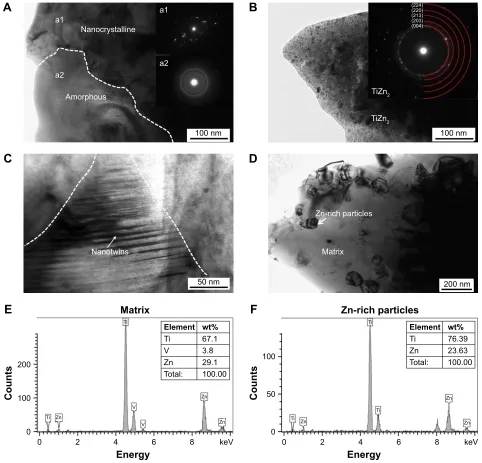 Figure 2 TeM images of upper surface (within 200 μm) in Zn-I-FsP group alloy.Notes: (A) Nanocrystalline (a1) and amorphous (a2), (B) TiZn2, (C) twins, (D) Zn-rich particles and matrix, and (E and F) eDs composition analysis of Zn-rich particles and matrix, respectively, in Figure 1D.Abbreviations: eDs, energy-dispersive X-ray spectroscopy; FsP, friction stir processing; TeM, transmission electron microscopy; wt, weight; Zn, zinc.