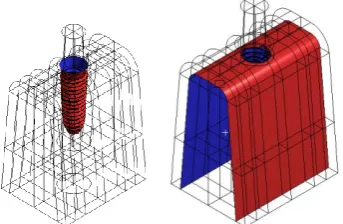 Fig -8: Angular forces applied on Implant assembly 