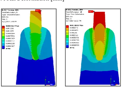 Fig -11 : Equivalent (Von-Mises) Stress of Assembly 