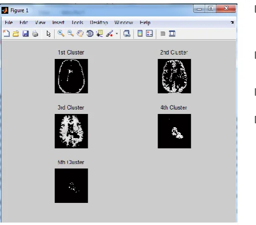 Figure 4.2 Clustered Image. 
