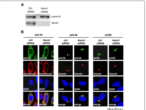 Fig. 2 Targeting and membrane insertion of HSV1 pUL34, pUL56 and pUS9 occur independent of Asna1/TRC40